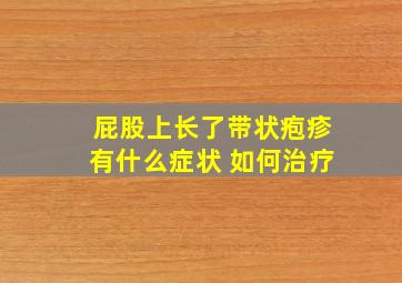 屁股上长了带状疱疹有什么症状 如何治疗